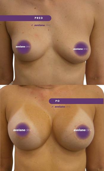 Vyváženie estetických proporcií