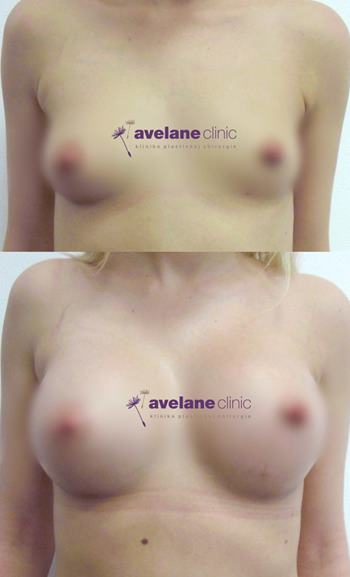 Prirodzený a harmonický vzhľad