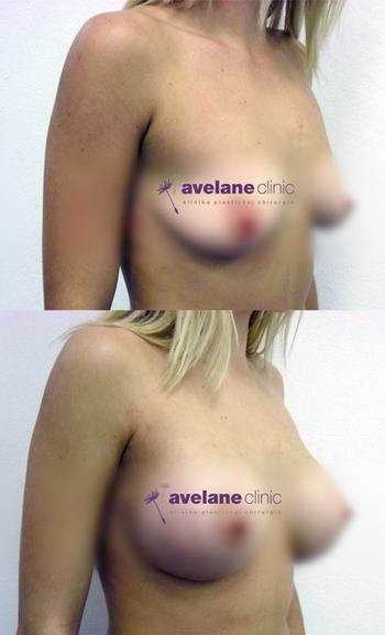 Vyvážený a prirodzený tvar