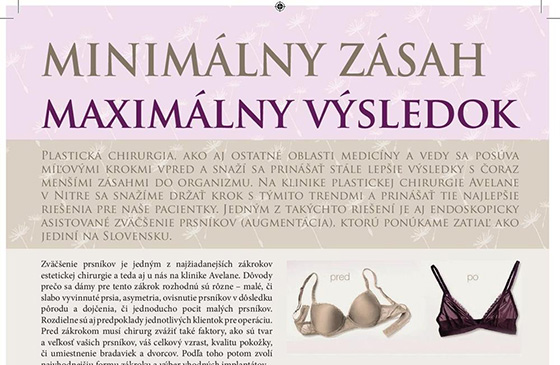 Minimálny zásah – Maximálny výsledok