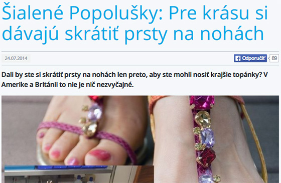 Šialené Popolušky: Pre krásu si dávajú skrátiť prsty na nohách