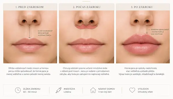 Lip lift